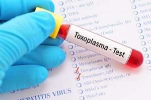 Toxoplasmose Test